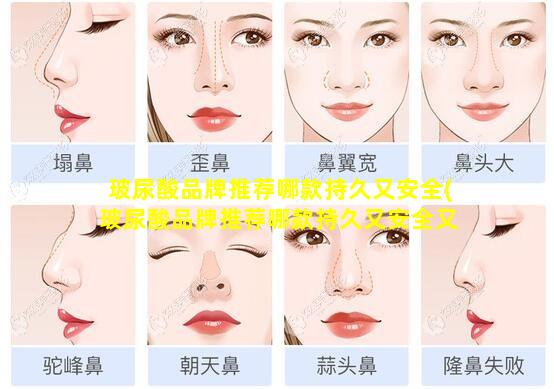 玻尿酸品牌推荐哪款持久又安全(玻尿酸品牌推荐哪款持久又安全又好 🌴 用)